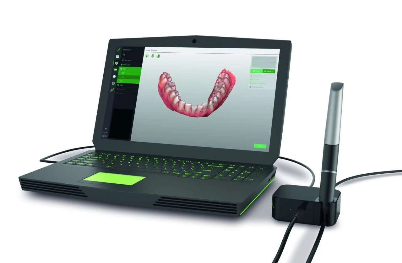Scanner Intraorale